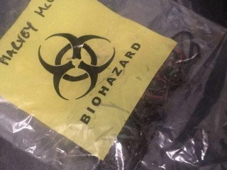 A clear bag displays a yellow biohazard label with the word 