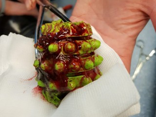 A green object covered in red sauce is held by a hand on a white cloth. Metal tongs grip the object. The setting appears clinical, like a hospital or lab.