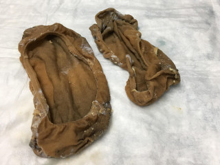 Two deteriorated, brown shoe inserts with peeling material lie on a white, textured surface.