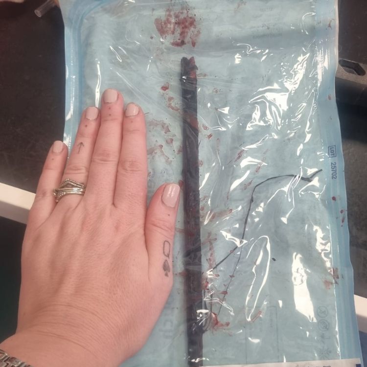The stick removed from Sidney the dog's stomach during treatment at Vets Now Belfast, shown next to a hand for size comparison.