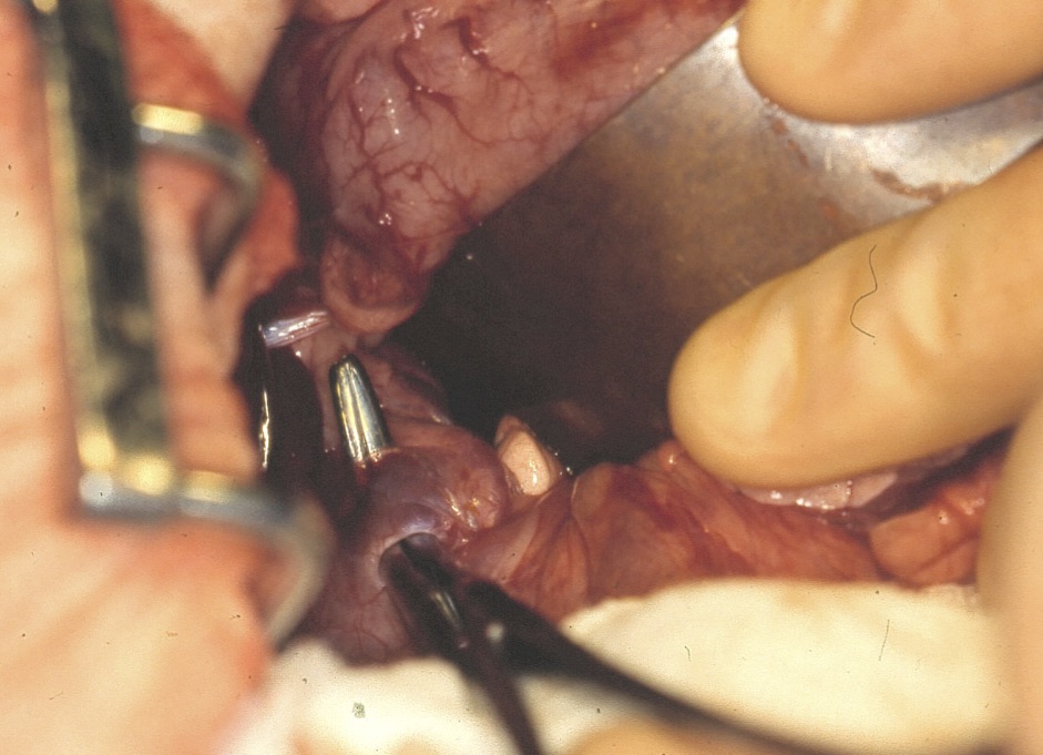 vets-now-john-williams-border-terrier-case-study-surgery1 Surgical procedure performed on internal organs; hands use medical instruments to manipulate tissues; clinical setting with noticeable metal retractors and visible tissue layers.