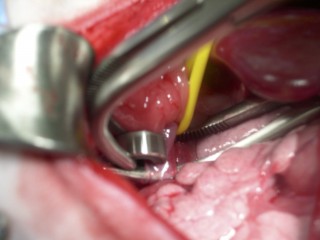 vets-now-john-williams-border-terrier-case-study-surgery3 Surgical instruments hold open flesh, revealing pink tissue and a yellow tube inside a medical setting.