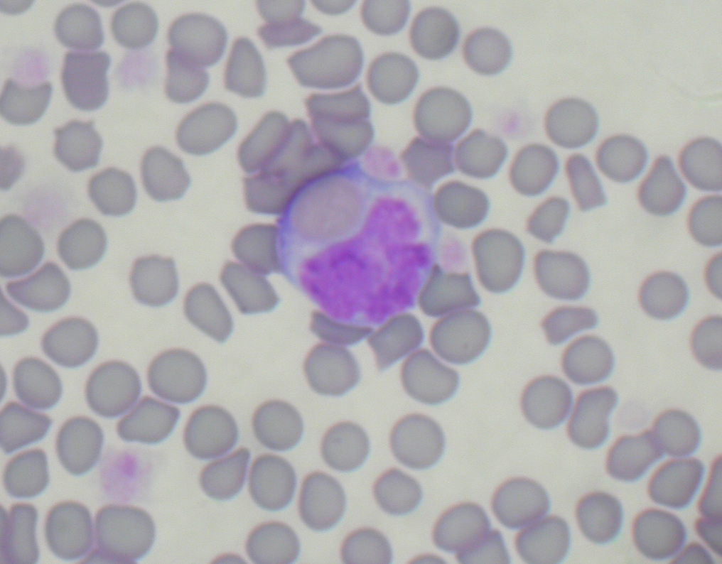 Non-regenerative immune-mediated haemolytic anaemia in a cat