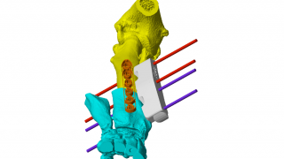 The model of Baxter's leg using 3D technology